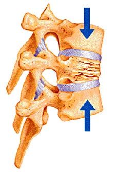 scalene compression test|compression fracture of thoracic vertebra.